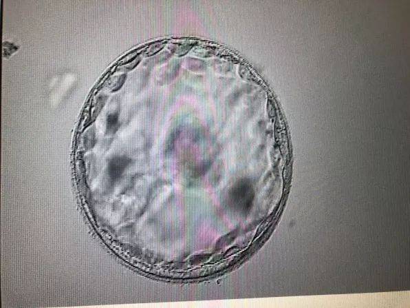 预产期日期计算在线