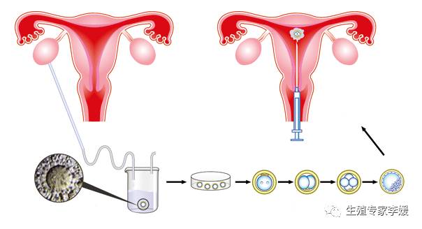 预产期计算方法
