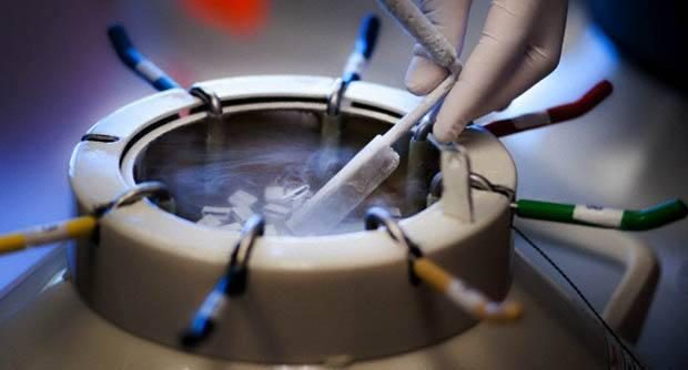 顺产后下面松弛