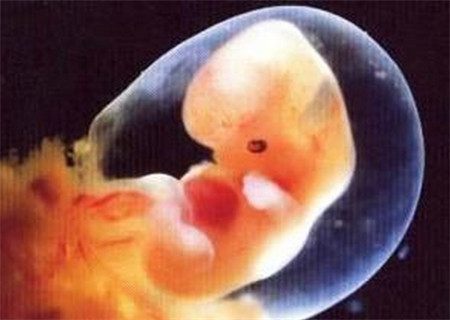 生产时的宫口直拍