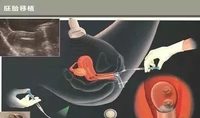 预产期电影简介