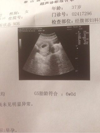 南宁代生宝宝费用